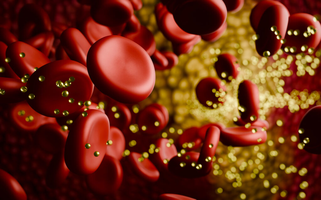 Cholesterol Benefits Sauna