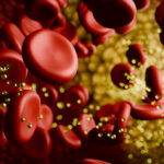 Cholesterol Benefits Sauna