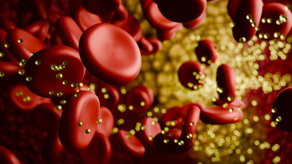 Cholesterol Benefits Sauna